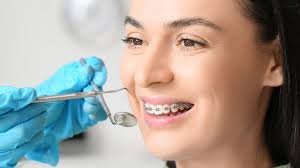Dental Braces Treatment